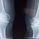 wkładki ortopedyczne